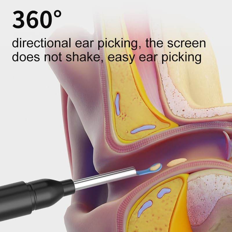 Smart HD Ear Cleaner with Camera – Wireless Otoscope Wax Removal Tool for Baby & Adults (iOS & Android Compatible